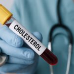 Zdrowe odżywianie dla osób z wysokim cholesterolem